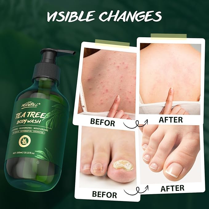 Tea Tree Oil Body Wash Natural Organic Mint Eucalyptus Coconut Oil Shower Gel for Men Women Soothes Irritation Moisturizes Dry Helps Back Acne Athletes Foot Body Odors Parabens Free Sulfate Free