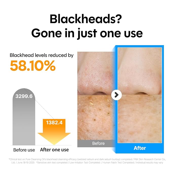 ma:nyo Pure Cleansing Oil, Natural Oil Cleanser for Face, Makeup Blackhead Remover, Korean Skin Care, 6.76 fl oz (200ml)