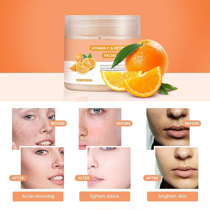 Vitamin C and Retinol Facial Scrub Face Scrubs Exfoliating Face Wash Vitamin C Facial Body Scrub Microdermabrasion Exfoliate Exfoliator for Blackhead Ingrown Hair KP Bump Eraser Exfoliant 3.5OZ