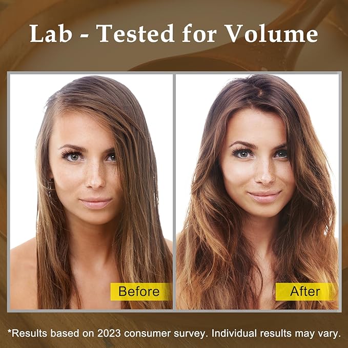 Rice Shampoo Bar and Conditioner Set - Promote Hair Growth & Strengthening Thinning Hair, Paraben Free and Sulfate Free with Natural Rice Water for Men & Women
