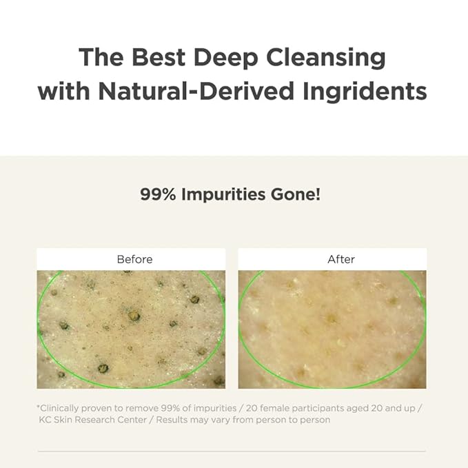 MANYO Pure & Deep Cleansing Foam, Korean Face Wash with Hyaluronic Acid, Acne Face Wash, Pore Cleaner, Blackhead Remover, Korean Skin Care, 6.7 fl oz (200ml)