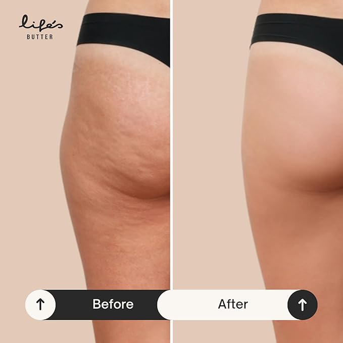 Life's Butter Body Butter – Rich, Non-Greasy Moisturizer with Jojoba, Almond & Argan Oils for Deep Hydration, Nourishing Dry Skin, Firming & Smoothing Arms, Legs & Body – 100% Natural Ingredients