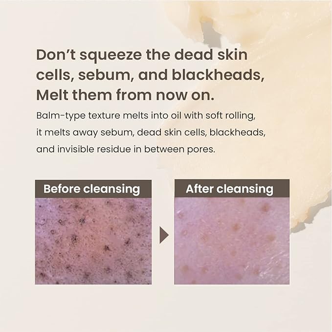 HEIMISH All Clean Balm Mandarin 4.0fl.oz/120ml - Cleansing Balm, Waterproof Makeup Remover, Face Cleanser, Oil Based Cleanser, Korean Skincare with Natural Aroma Oil, Vegan, For All Skin Types