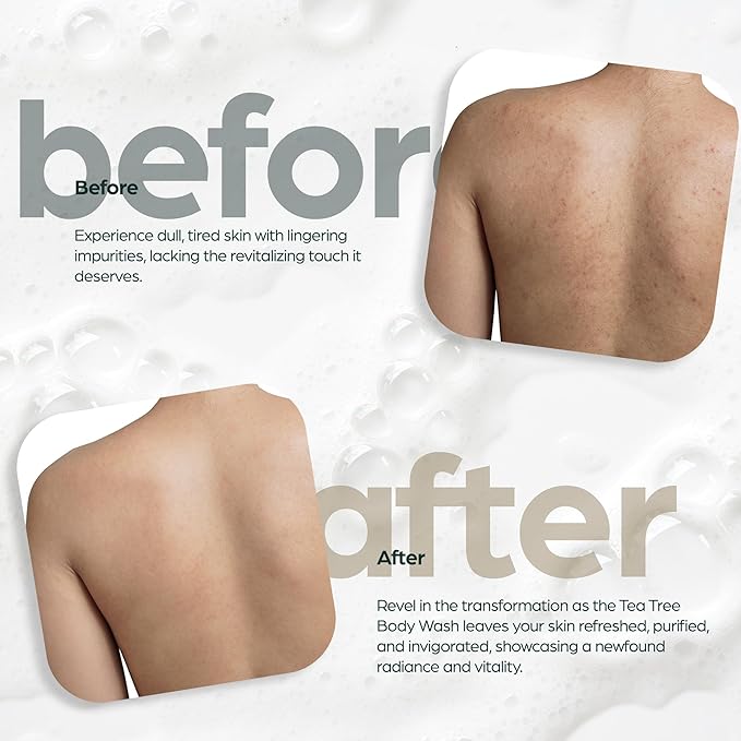 Antibacterial Tea Tree Oil Body Wash For Men & Women Remedy Soap Extra Strength - Helps Treat Acne, Athletes foot, Eczema, Toenail Fungus & Jock Itch & Ringworm (16 Fl Oz (Pack of 2)