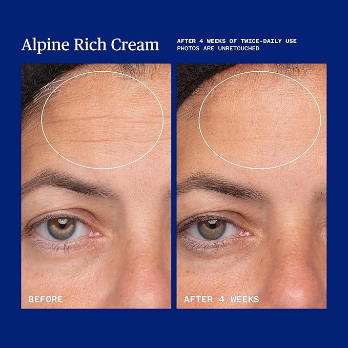 Ursa Major Alpine Rich Cream | Deeply Hydrating & Moisturizing Natural Face Lotion | Supports Skin Barrier and Targets Fine Lines | Vegan, Non-Toxic, Cruelty-Free | 1.69 ounce